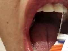 My first full mouth check - Short version